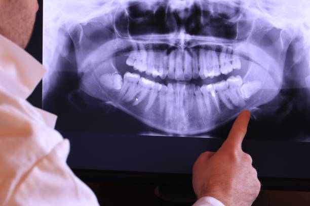 Best Emergency Tooth Extraction in Mccom, MS